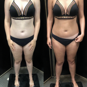 Spray Tan Before and After