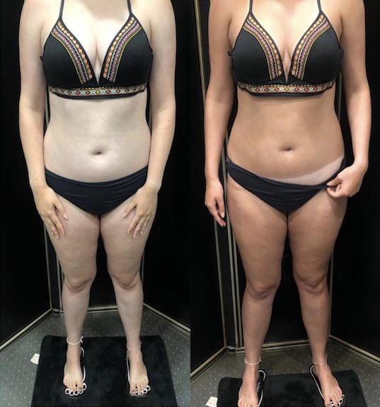 Spray Tan Before and After